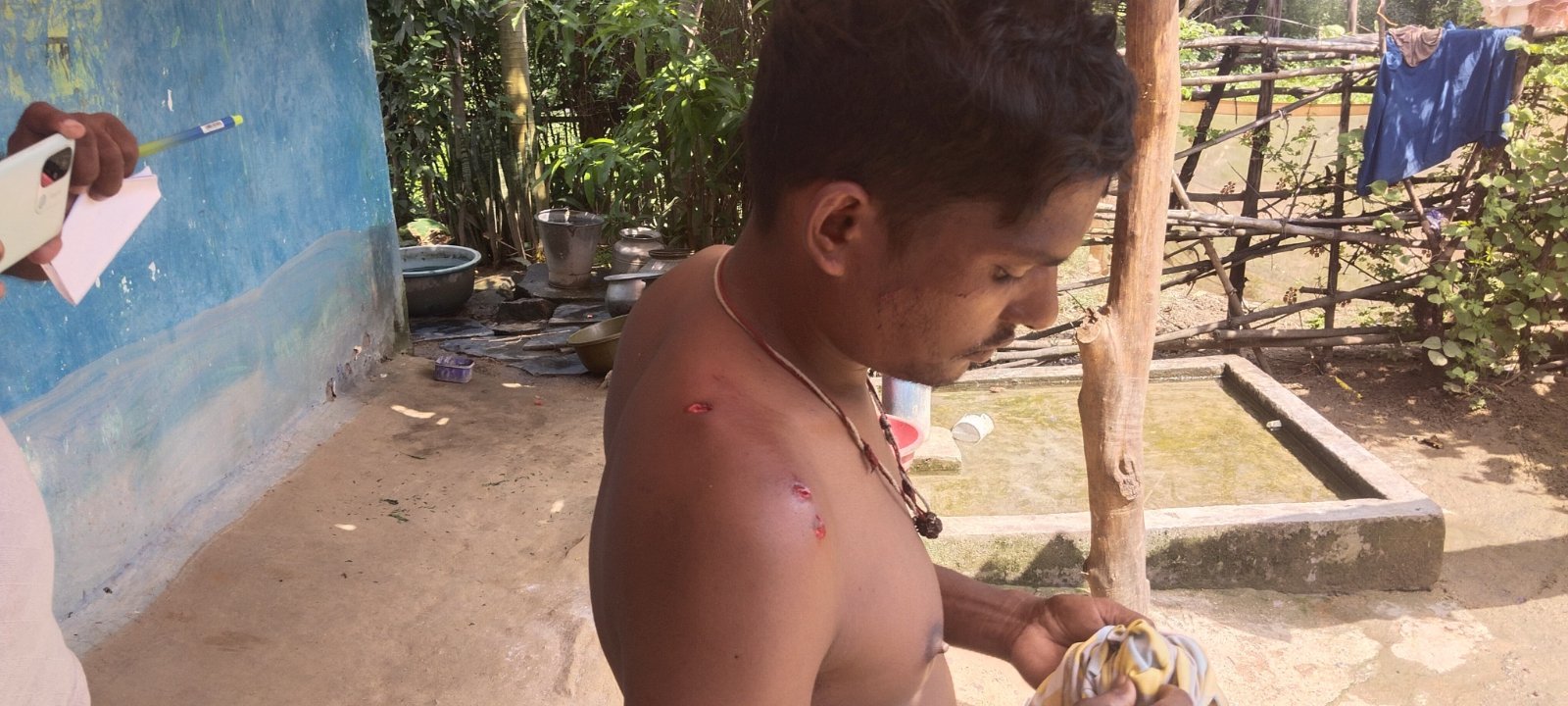 वन विभाग की टीम या अन्य व्यक्ति घायल युवक के कंधे के घाव की जांच कर रहे हैं।